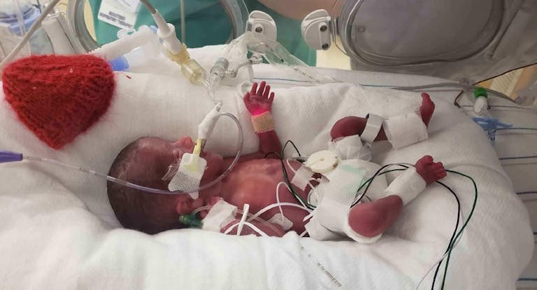 baby mackenzie at birth