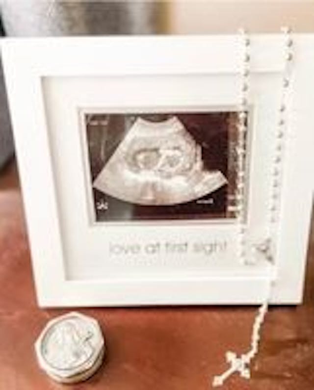 Baby Rose. Photo courtesy of Julie Loin. Do not duplicate. ‘There is no heartbeat’: The pro-abortion lie that minimizes the miscarriages of women everywhere image