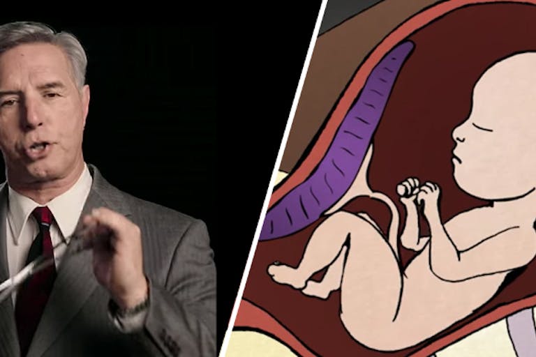 abortion videos, Abortion facts, Go to www.AbortionProcedures.com for facts on abortion