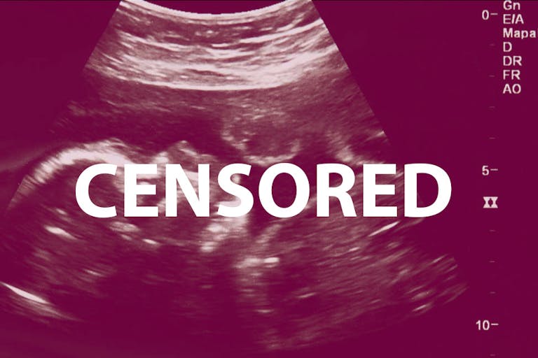 ultrasound, censored, Pinterest