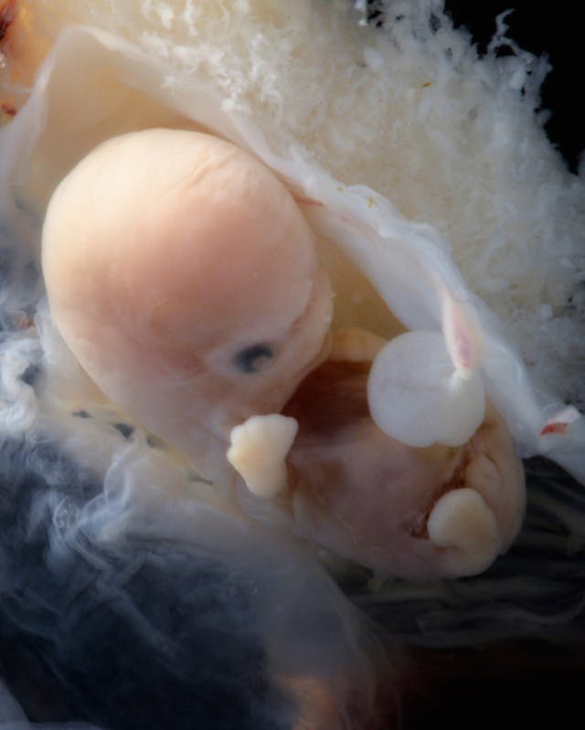 A human embryo 6-7 weeks from fertilization. (8-9 weeks gestational age) heartbeat, Georgia, pregnancy