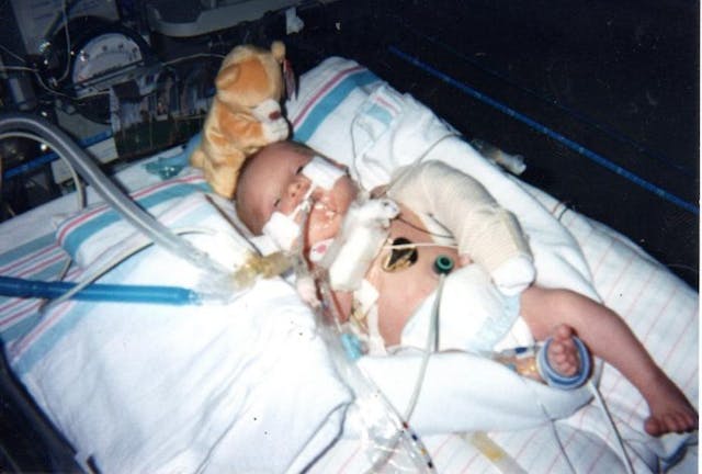 Belinda as a baby in the NICU Down syndrome