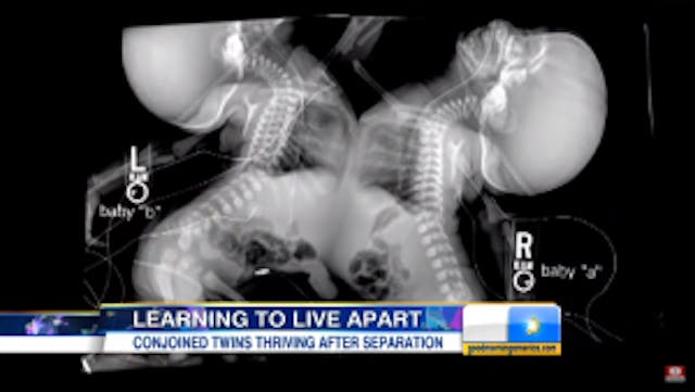 Screenshot from ABC Good Morning America interview / Youtube Screenshot 2016-07-14 13.36.21