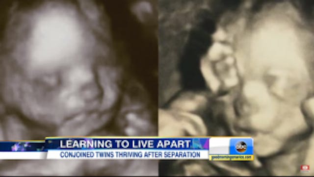 Screenshot from ABC Good Morning America interview / Youtube. Screenshot from ABC Good Morning America interview / Youtube.