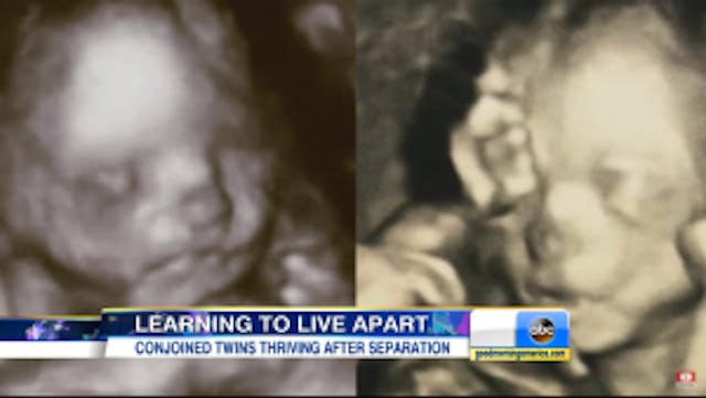 Screenshot from ABC Good Morning America interview / Youtube.