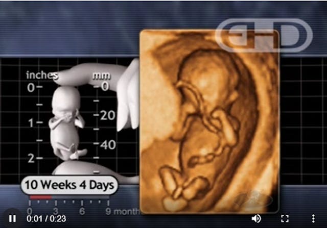 Responding to a pro-abortion OB/GYN: A preborn baby is not merely a ‘potential’ human image
