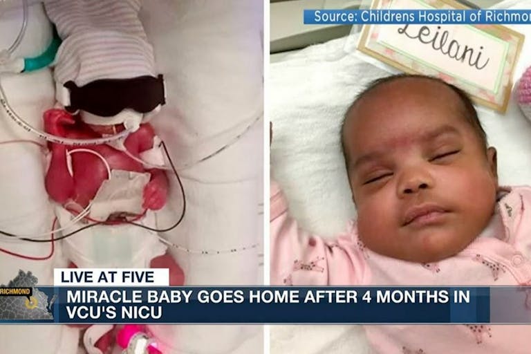 micro-preemie Leilani