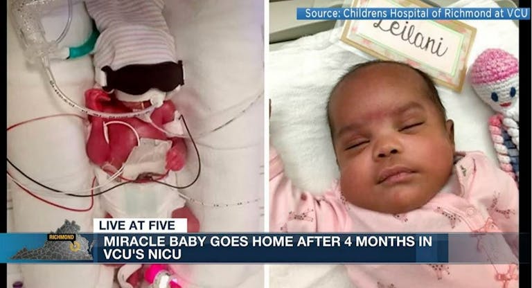 micro-preemie Leilani