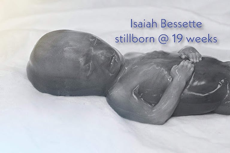 stillborn 19 weeks