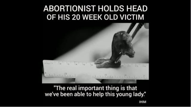 Sorry, VICE. Abortionists’ own words prove this Live Action abortion video is accurate image