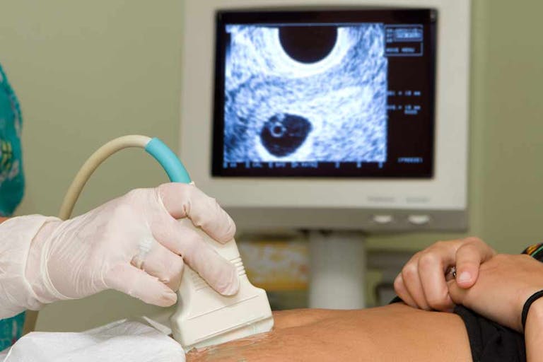 ultrasound, pregnancy centers