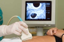 ultrasound, pregnancy centers
