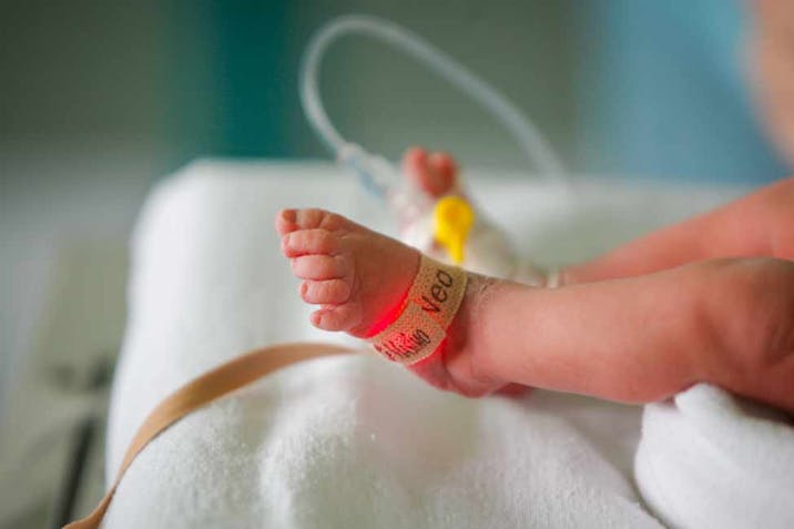 Photo: Shutterstock Close up of a baby's foot with a medical bracelet around it.