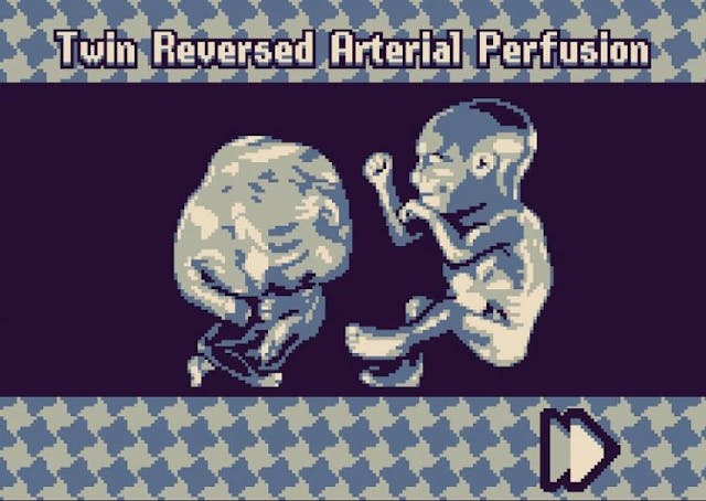 Abortion in video games: The next frontier of entertainment? image