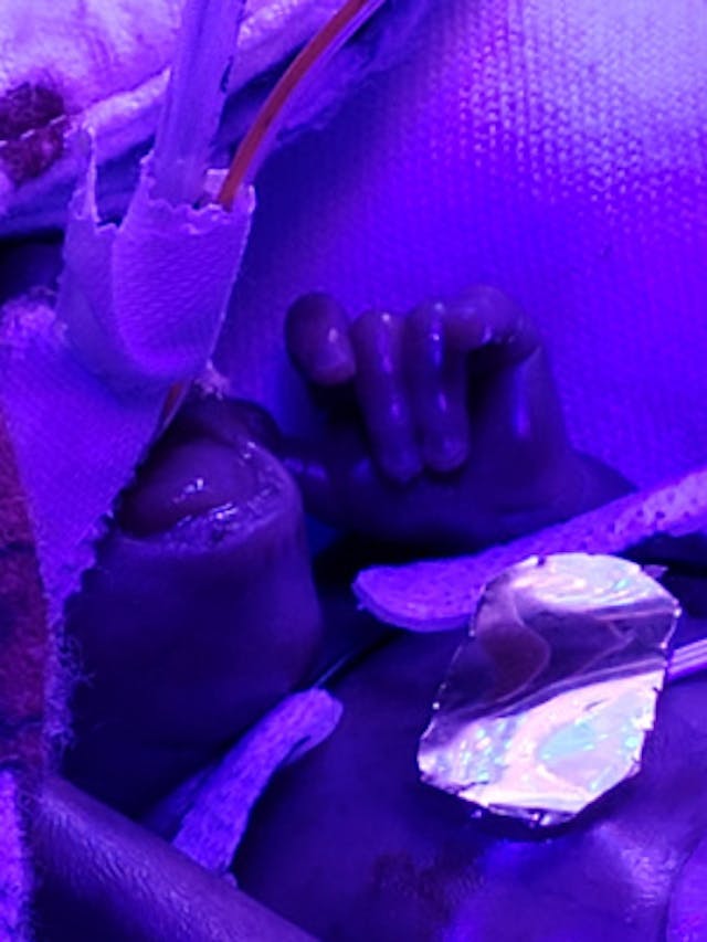 Jaden’s tiny, but formed, hand. Photo via Caring Bridge. 23 weeks