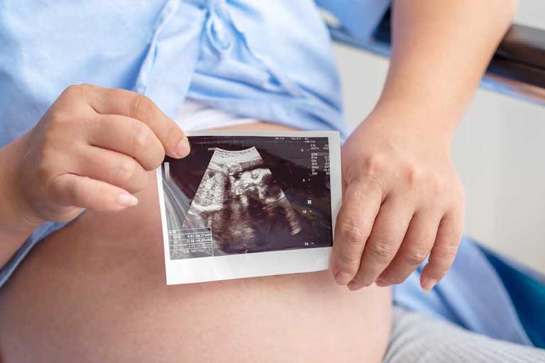 pregnant, pregnancy centers, ultrasound baby bump, abortions
