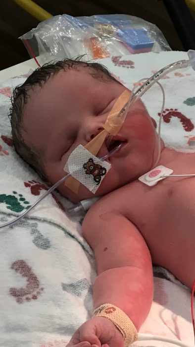 Baby Issac lived only a few days after birth, but his legacy will live forever image