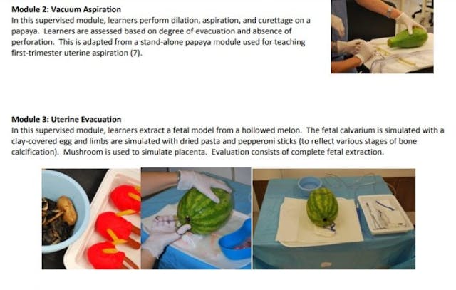 UCSF abortion training uses melons and Papaya Image: UCSF abortion training uses melons and Papaya