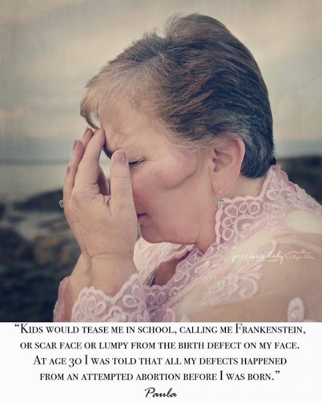 Photo: Angela Forker (Facebook) abortion survivor