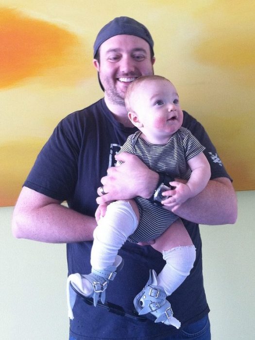 Experimental fetal surgery saved my son’s life at 19 weeks image