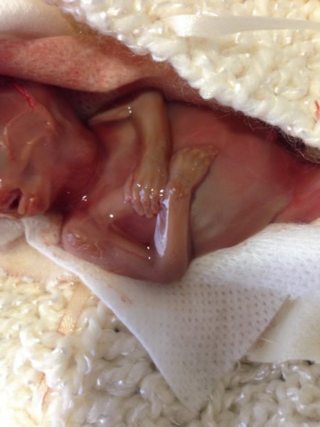 Martin, Kyle Marie’s son, 16 weeks Martin, Kyle Marie’s son, 16 weeks