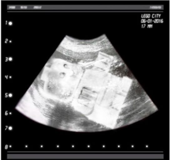 LEGO, ultrasound