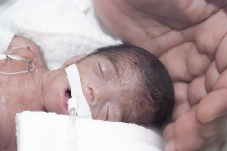 premature-baby-face