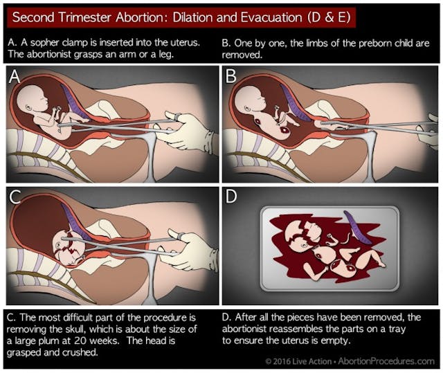 Requests for this procedure at Planned Parenthood were sent to the top of the queue.