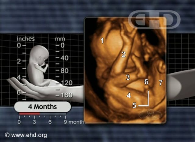 Woman four months pregnant says abortion facility told her: ‘It’s not a child. It’s a sac.’ image
