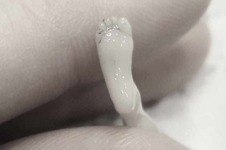 Baby Miran miscarried at 14 weeks