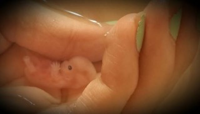 Annabelle at 8 weeks, 5 days – a common age for Planned Parenthood’s abortions. was 8 weeks, 5 days old when her mother had a miscarriage and took this photo of her.