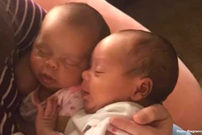 twins saved abortion pill reversal