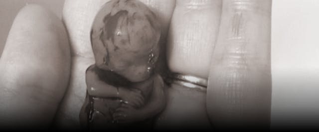 Baby Ezekiel miscarried at 11 weeks. Baby Ezekiel miscarried at 11 weeks.