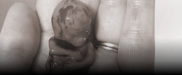 Baby Ezekiel miscarried at 11 weeks.
