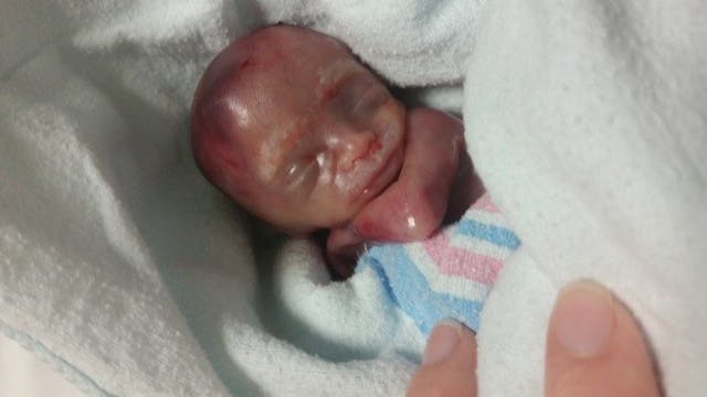Baby Greyson, miscarried at 19 weeks.