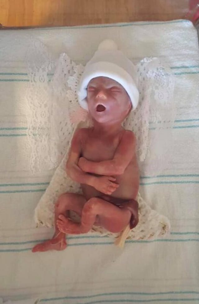 Cayden, stillborn at 24 weeks. Cayden, stillborn at 24 weeks.