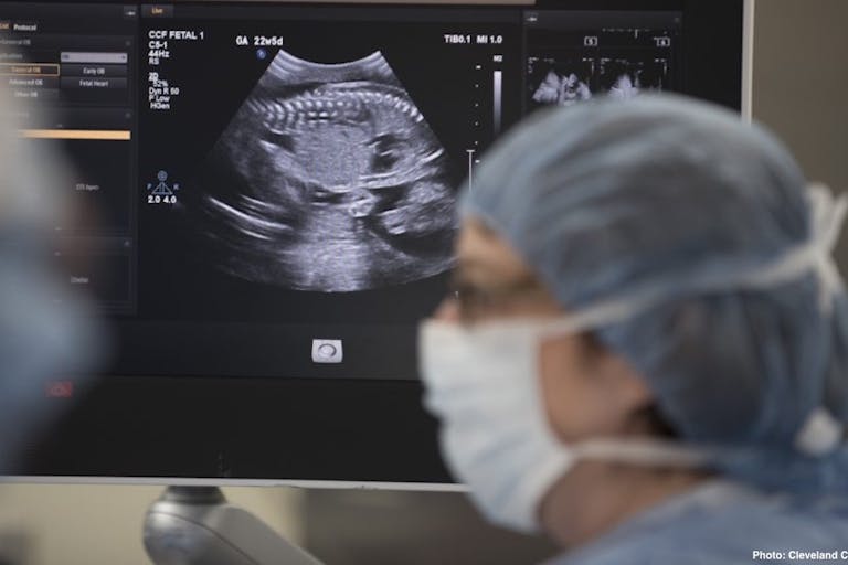 spina bifida surgery