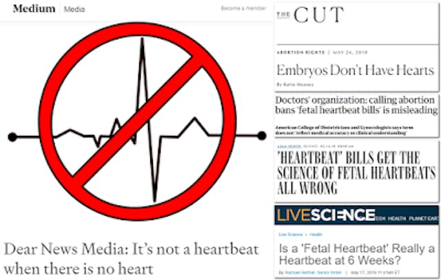 ‘Pulsing cells’: 13 ways the media has dehumanized humans in the womb image