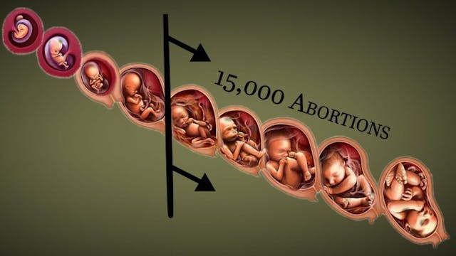 WATCH: New video shatters media’s lies about late-term abortion image