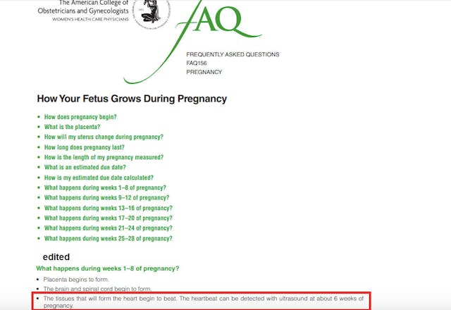 ACOG document on fetal development refers to six week “heartbeat” (HT: Carole Novielli) Why has ‘heartbeat’ just become a ‘medically inaccurate’ term? Abortion. image