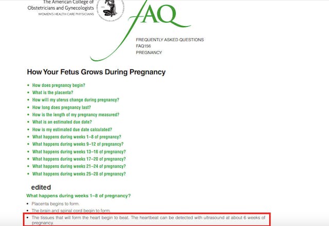 Why has ‘heartbeat’ just become a ‘medically inaccurate’ term? Abortion. image
