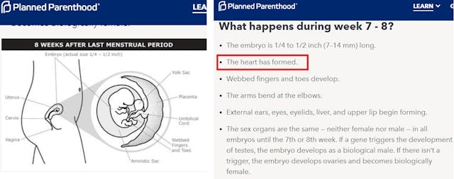 Planned Parenthood fetal heart develops 7 weeks (Images PPFA’s website accessed 04162019) Image: Planned Parenthood fetal heart develops 7 weeks (Images PPFA's website accessed 04162019)