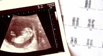 abortion, pregnancy, Louisiana, ultrasound, heartbeat