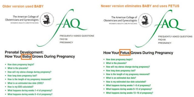 Why has ‘heartbeat’ just become a ‘medically inaccurate’ term? Abortion. image