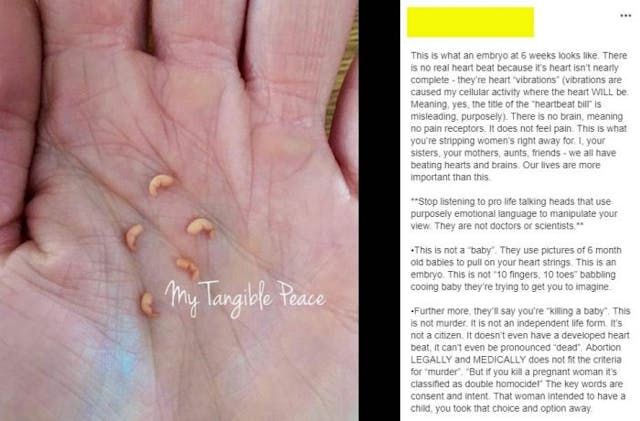 via Secular Pro-life (name removed) Hey, media: Calling an embryo’s heartbeat a ‘heartbeat’ is medically correct image