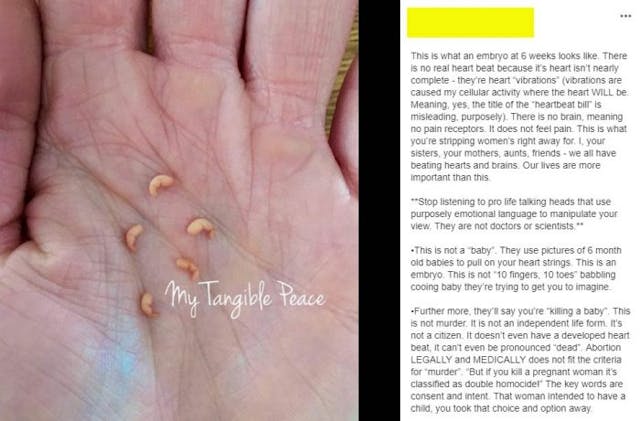 Hey, media: Calling an embryo’s heartbeat a ‘heartbeat’ is medically correct image