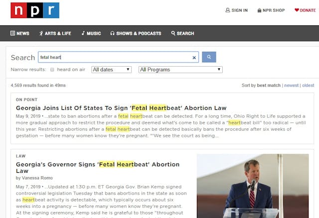 NPR fetal heart used 4500 times Image: NPR fetal heart used 4500 times
