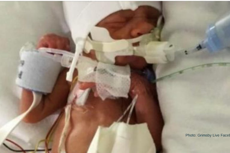 preemie