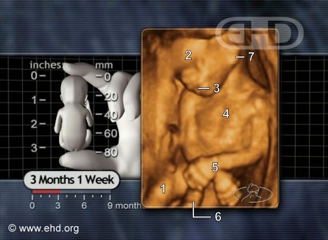 Former Planned Parenthood staff: Hush money, hiding abortion injuries common image