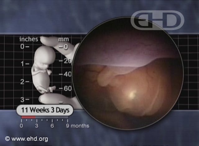11 weeks post-fertilization (13 weeks pregnant). Creation Museum set to open exhibit on life inside the womb this fall image